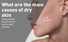 Aké sú hlavné príčiny suchej pokožky