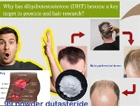 Prečo sa DHT stal kľúčovým cieľom výskumu prostaty a vlasov