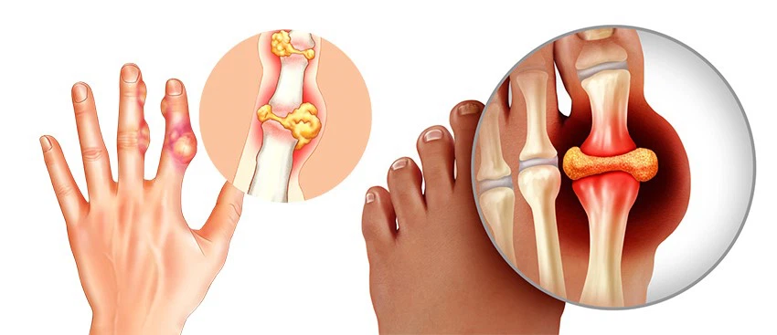 Colchicine Powder-1 Colchicine Powder-1